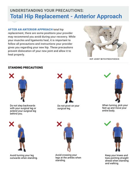 posterior hip precautions handout|Hip Replacement (Posterior) Precautions: What to Expect at Home.